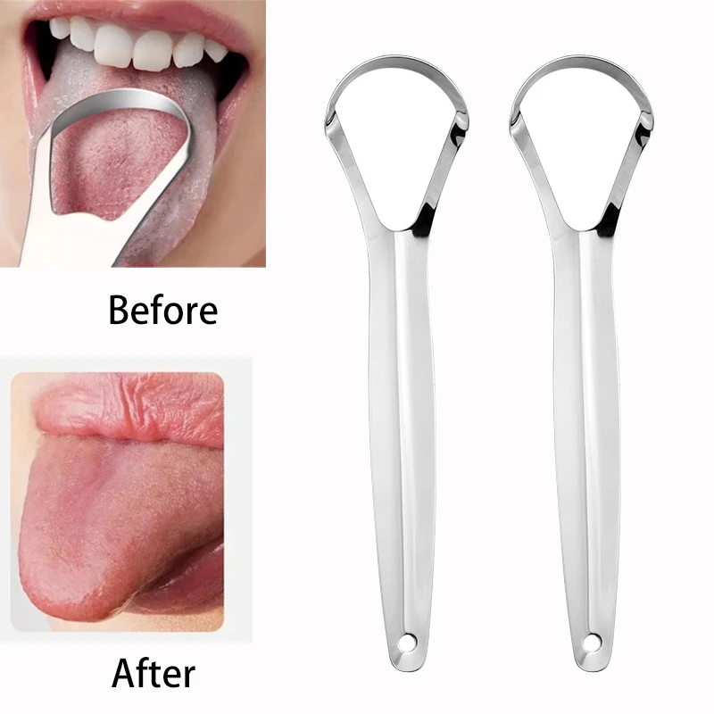 Tongue Scraper Metal - Mundgeruch Zungenbeschichtung Zungenschaber Edelstahl Reinigungsentferner Zungenbeschichtete