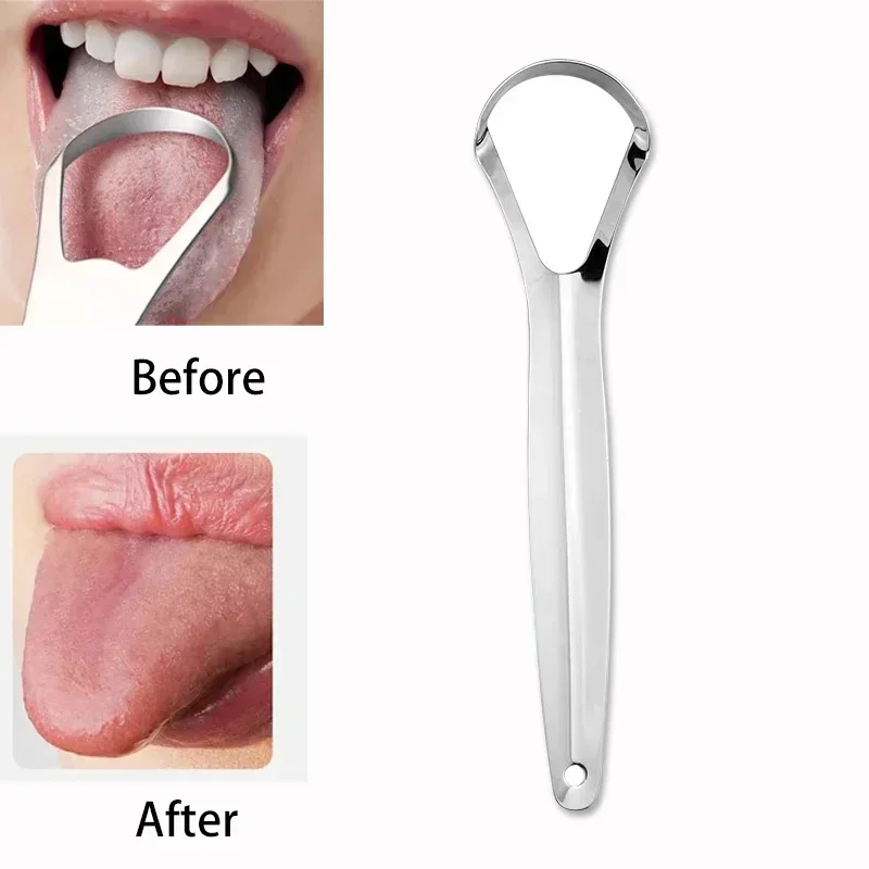 Tongue Scraper Metal - Halitosis Zungenbelag Zungenschaber Edelstahl Reinigungsbürste Zungenbelag-Entferner