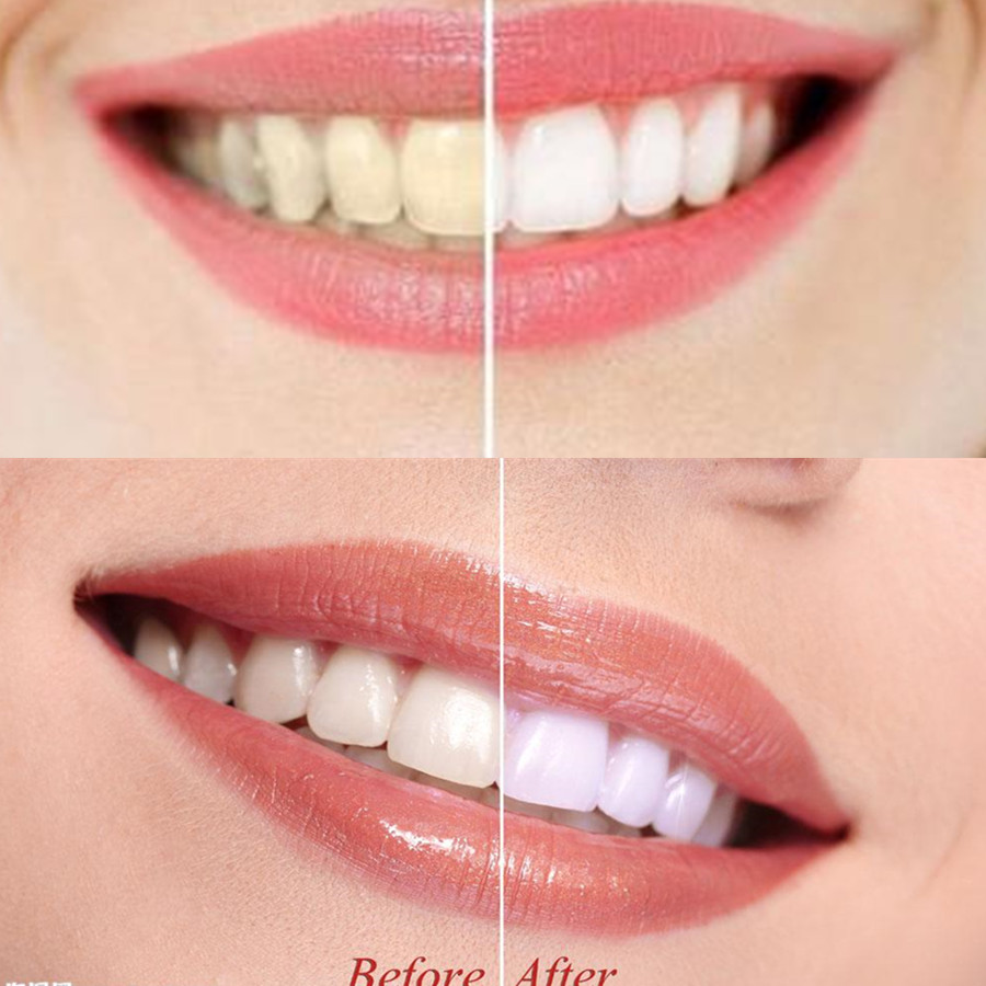 Bambus Holzkohle Zähne Zahn De – Teeth Whitening Co Bewertung und Preis