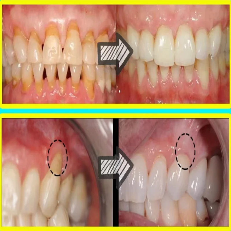 Schnell reparierendes Zahnflei – Teeth Whitening Baking Soda Bewertung und Preis