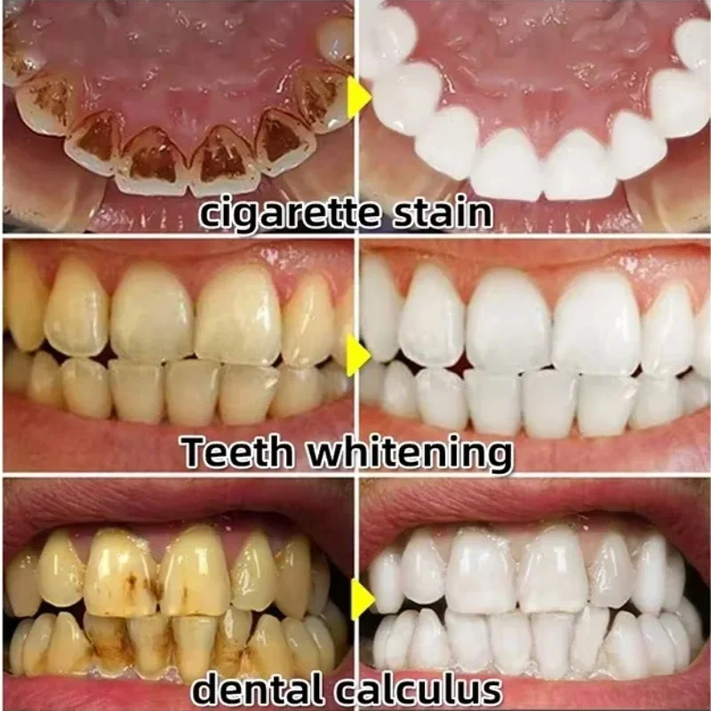 Schnell reparierendes Zahnflei – Teeth Whitening Baking Soda Bewertung und Preis