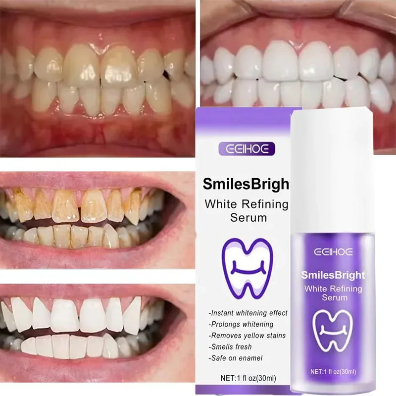 Zahnreinigung, Aufhellung, Zah – Teeth Whitening Korea Bewertung und Preis