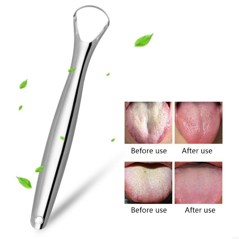G99E Edelstahl Zunge Schaber M – Tongue Scraper Metal Bewertung und Preis