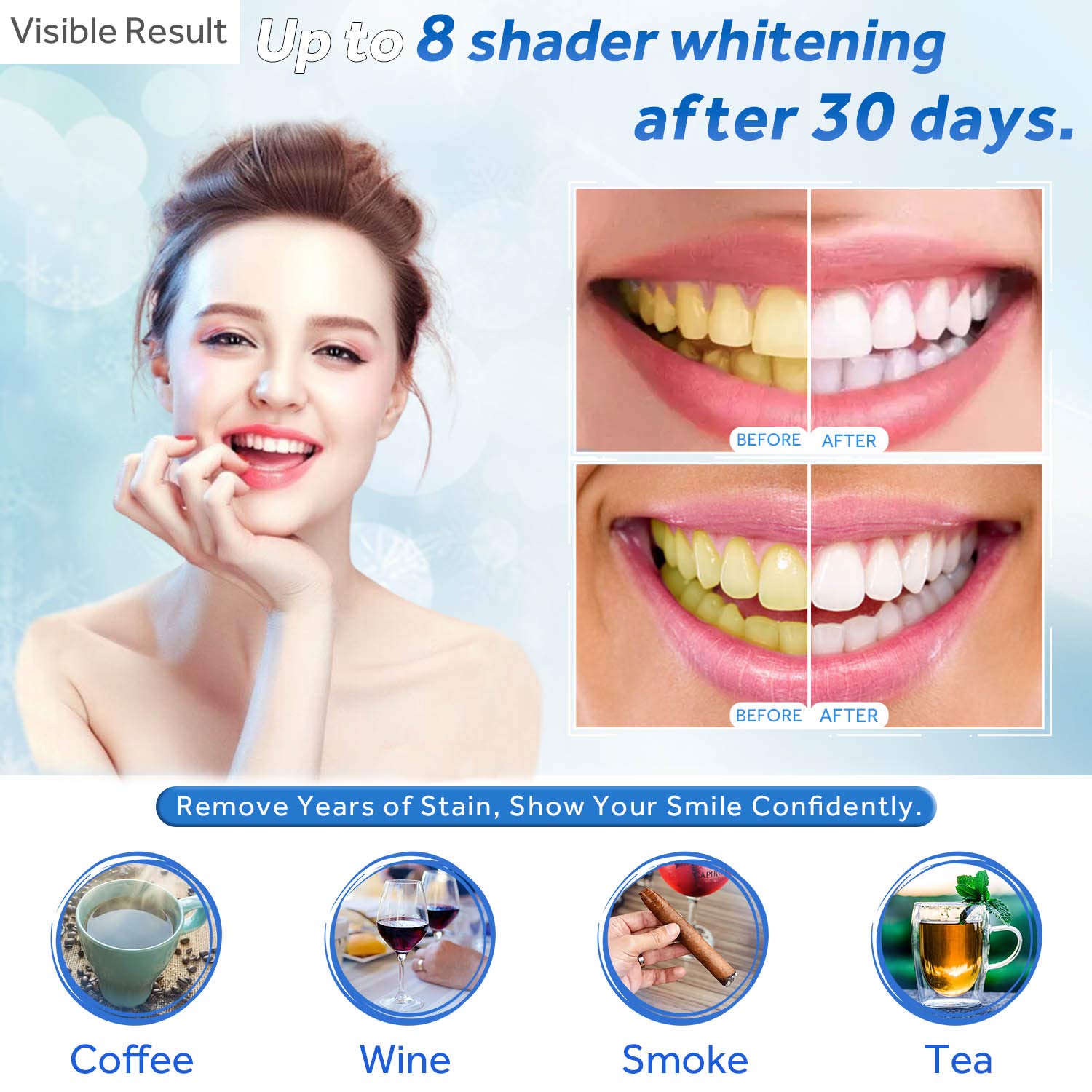 Zahnaufhellungsgel, Nachfüllsp – Teeth Whitening Q&M Bewertung und Preis
