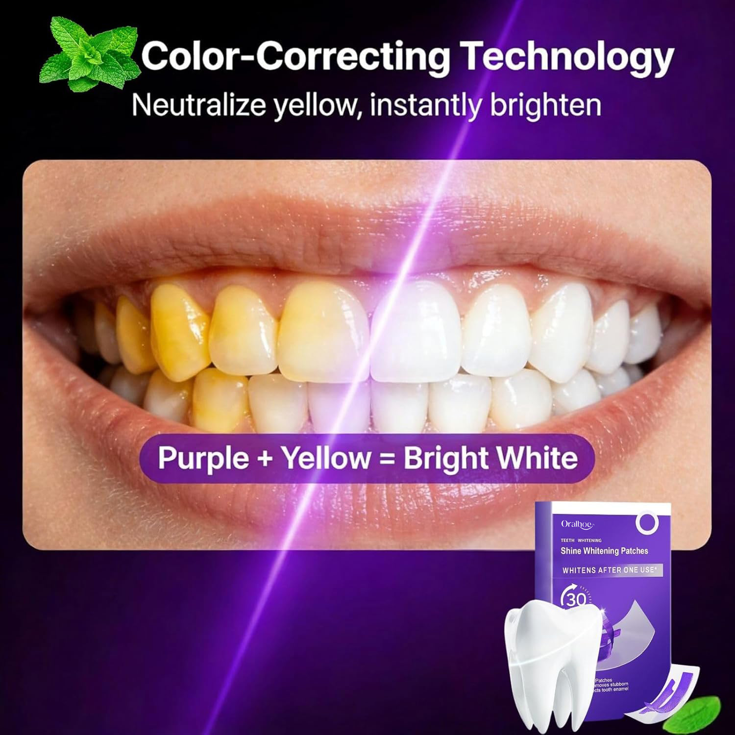 Lila Zahnaufhellungs-Kombi-Set – Teeth Whitening Home Kit Bewertung und Preis