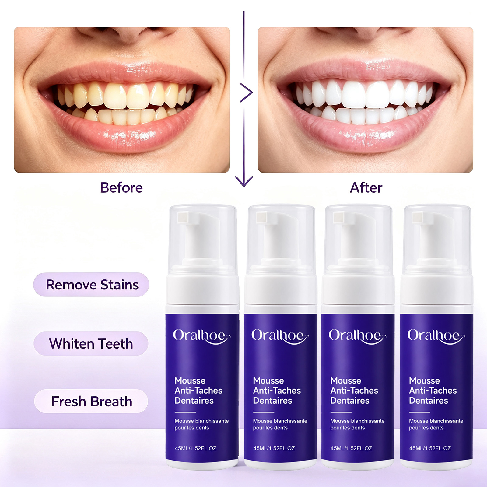 Lila schäumende Zahnaufhellung – Teeth Whitening Routine Bewertung und Preis