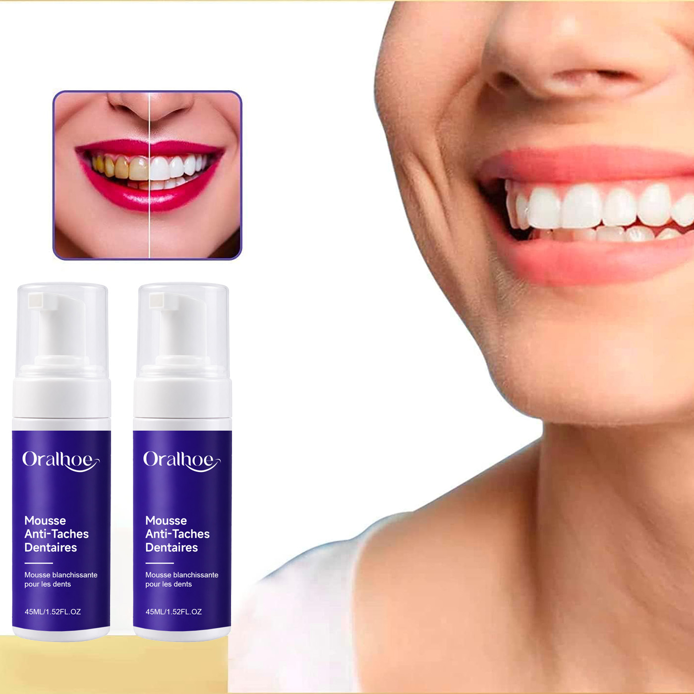Lila schäumende Zahnaufhellung – Teeth Whitening Routine Bewertung und Preis