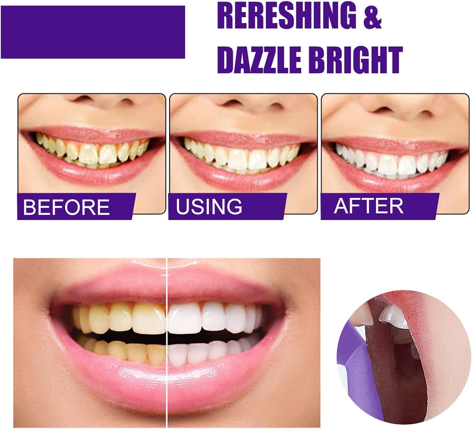 Lila schäumende Zahnaufhellung – Teeth Whitening Routine Bewertung und Preis