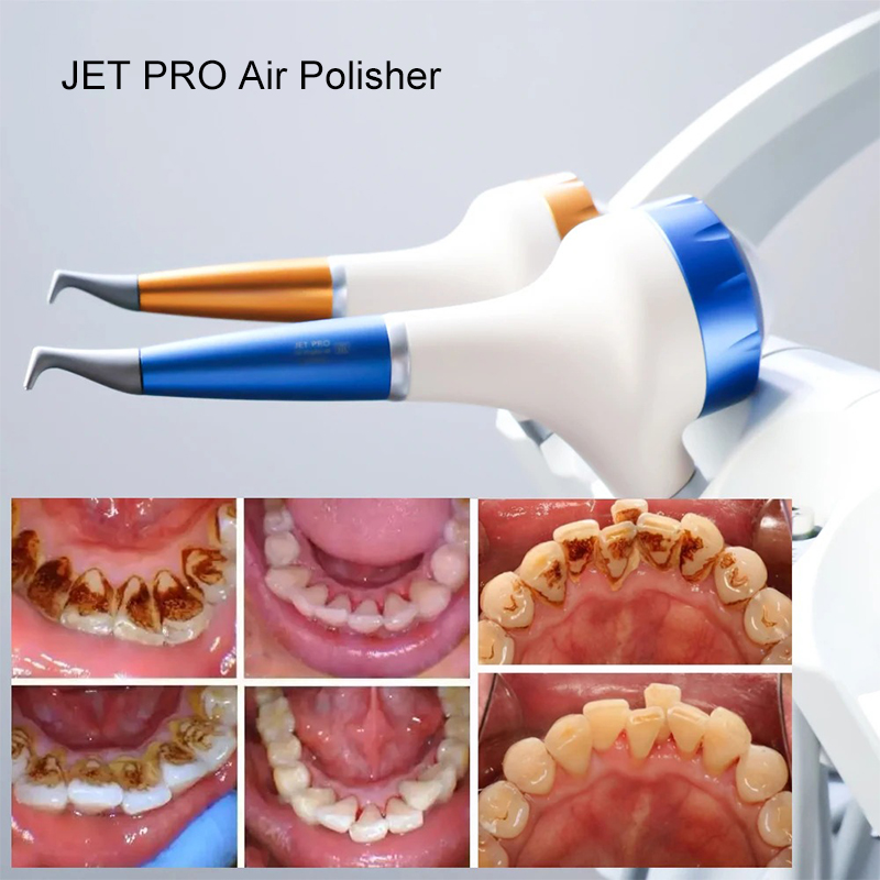 VV Dental Luftpoliergerät Prop – Teeth Whitening China Bewertung und Preis