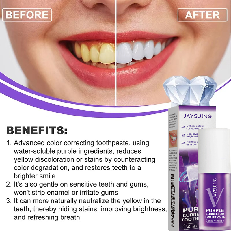 Zahnreinigungs- und Aufhellung – Teeth Whitening Korea Bewertung und Preis