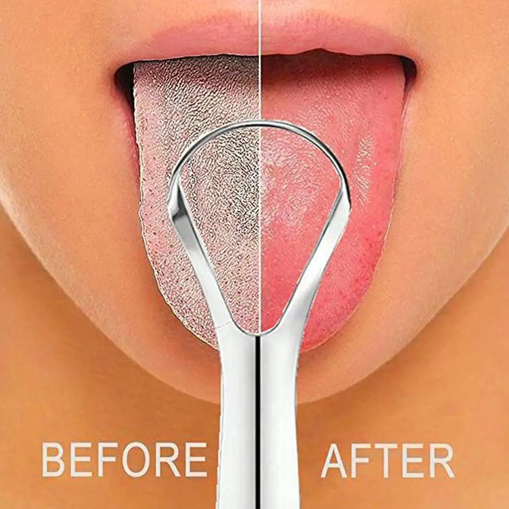 1–20 Stück Zungenschaber, Zung – Tongue Scraper Metal Bewertung und Preis