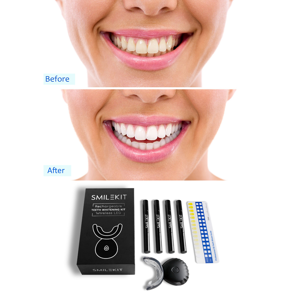 Neue Elektrische Zähne Bleachi – Teeth Whitening Home Kit Bewertung und Preis