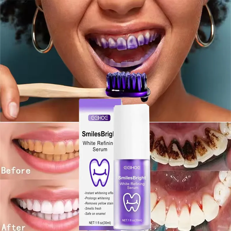 Zahnreinigung, Aufhellung, Zah – Teeth Whitening Korea Bewertung und Preis